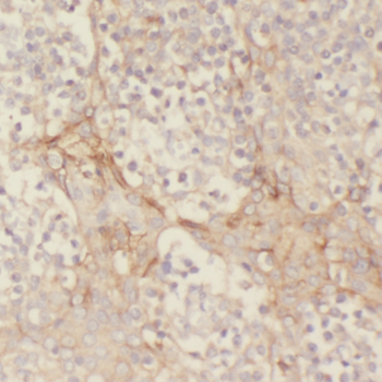CD7 Rabbit Polyclonal Antibody