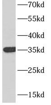 CD7 Mouse Monoclonal Antibody