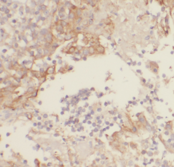 CD7 Mouse Monoclonal Antibody