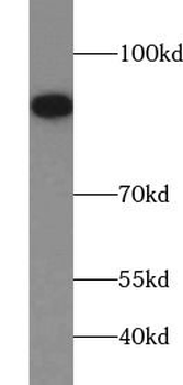 TFRC Antibody