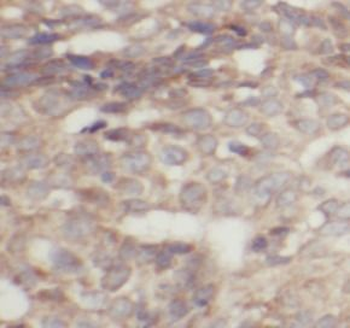 TFRC Antibody