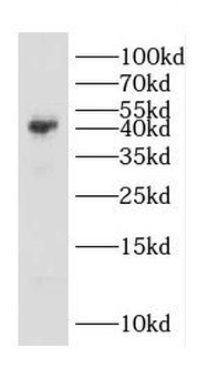 CD72 Rabbit Polyclonal Antibody