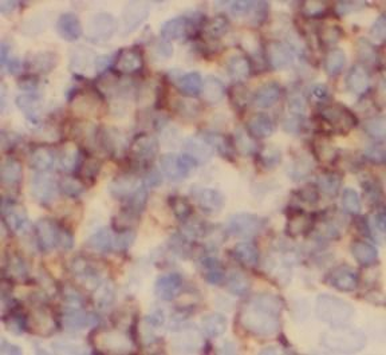 CD79A Antibody