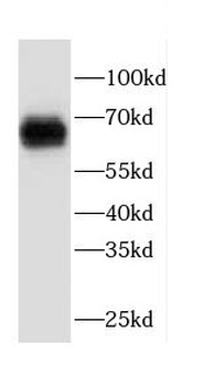 FCAR Rabbit Polyclonal Antibody