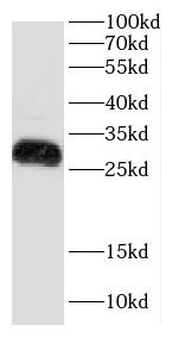 KLRD1 Rabbit Polyclonal Antibody