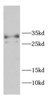 CD99 Antibody