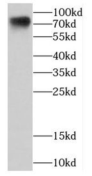 CDC16 Rabbit Polyclonal Antibody