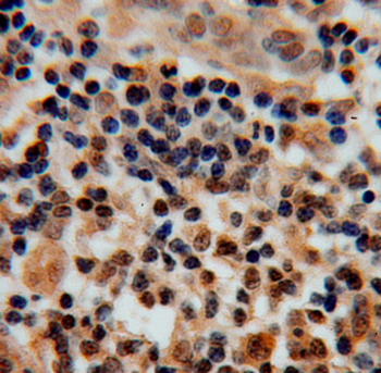CDC16 Rabbit Polyclonal Antibody