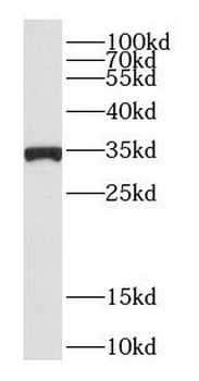 CDC34 Antibody