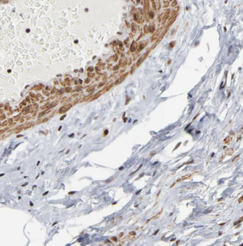 CDC34 Antibody