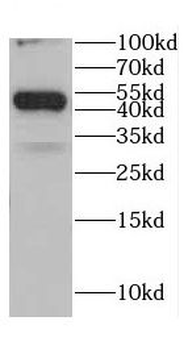 CDC42EP4 Antibody