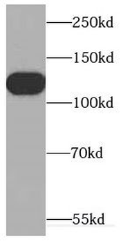 CDCA2 Antibody
