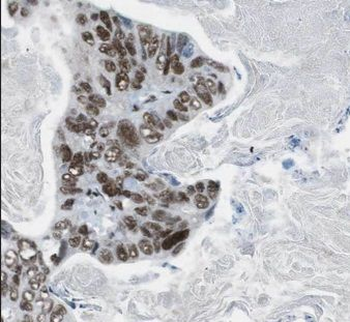 CDCA2 Antibody