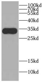 CDCA4 Antibody