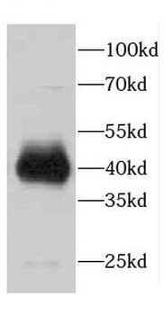CDCA7 Antibody