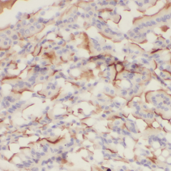 CDH17 Antibody
