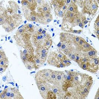 CDH23 Antibody