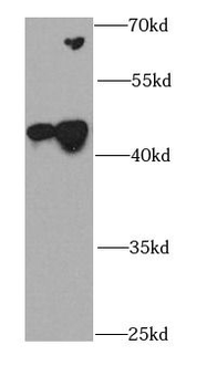 CDK10 Antibody