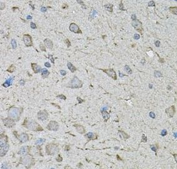CDK10 Antibody