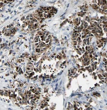 CDK2 Antibody