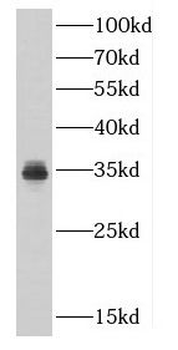 CDK5 Rabbit Polyclonal Antibody