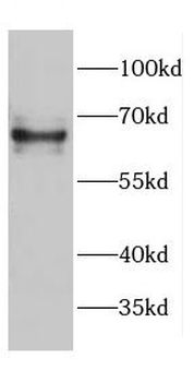 CDK5RAP3 Antibody