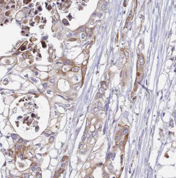 CDK5RAP3 Antibody