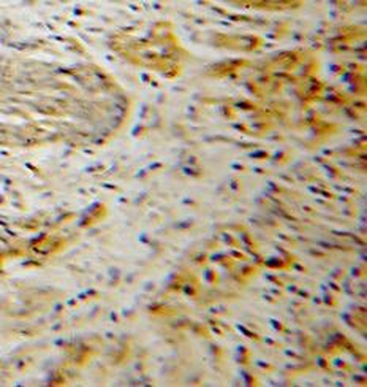 CDK6 Antibody