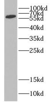 CDKN2AIP Antibody