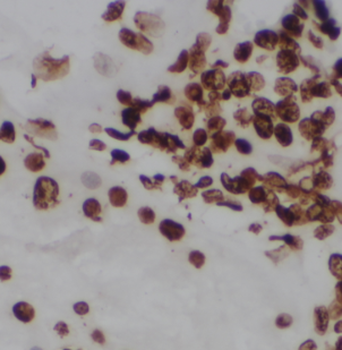 CDKN2AIP Antibody
