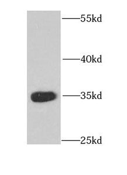 CDX1 Antibody