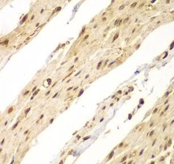 CDX1 Antibody