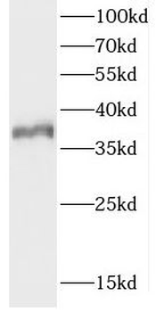 CDX4 Rabbit Polyclonal Antibody