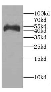 CEBPA Rabbit Polyclonal Antibody