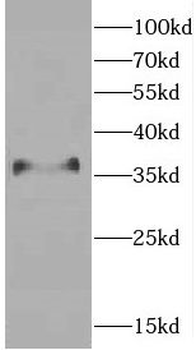 CEBPB Rabbit Polyclonal Antibody