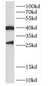 CENPN Antibody