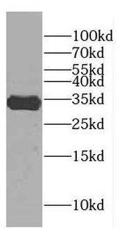 CENPP Antibody