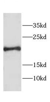 CETN1 Antibody