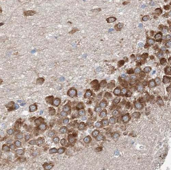 CETN2 Antibody