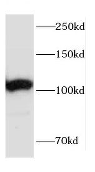 CEP152 Antibody