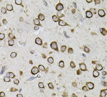 CEP164 Antibody