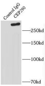 CEP290 Antibody