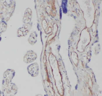 CEP290 Antibody