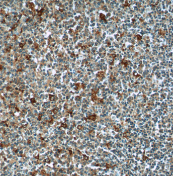 CEP63 Antibody