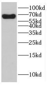 CEP68 Rabbit Polyclonal Antibody