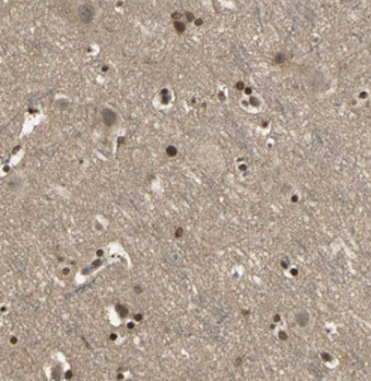 CEP68 Rabbit Polyclonal Antibody