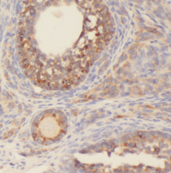 CEP70 Antibody