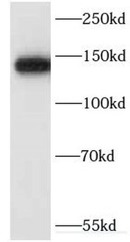 CP Rabbit Polyclonal Antibody