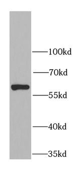 CES1 Antibody