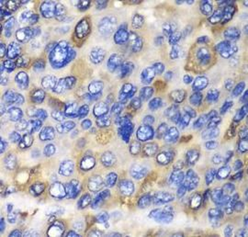 CES1 Antibody